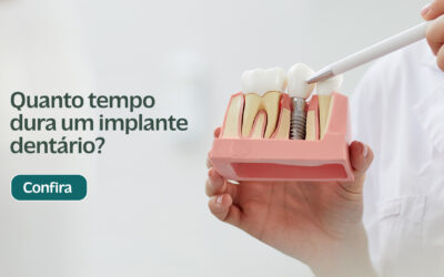 Quanto tempo dura um implante dentário?