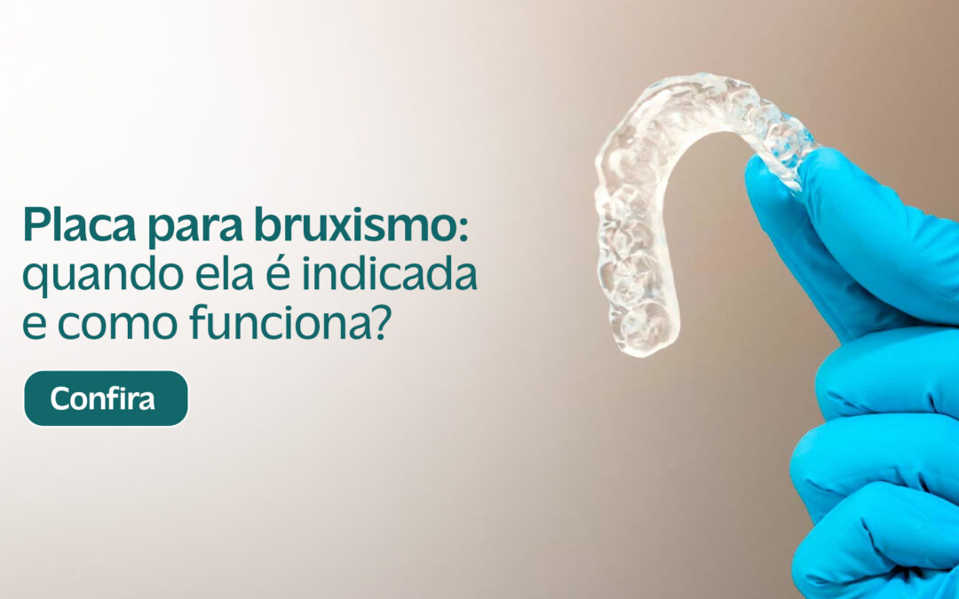 Placa para bruxismo: quando ela é indicada e como funciona?