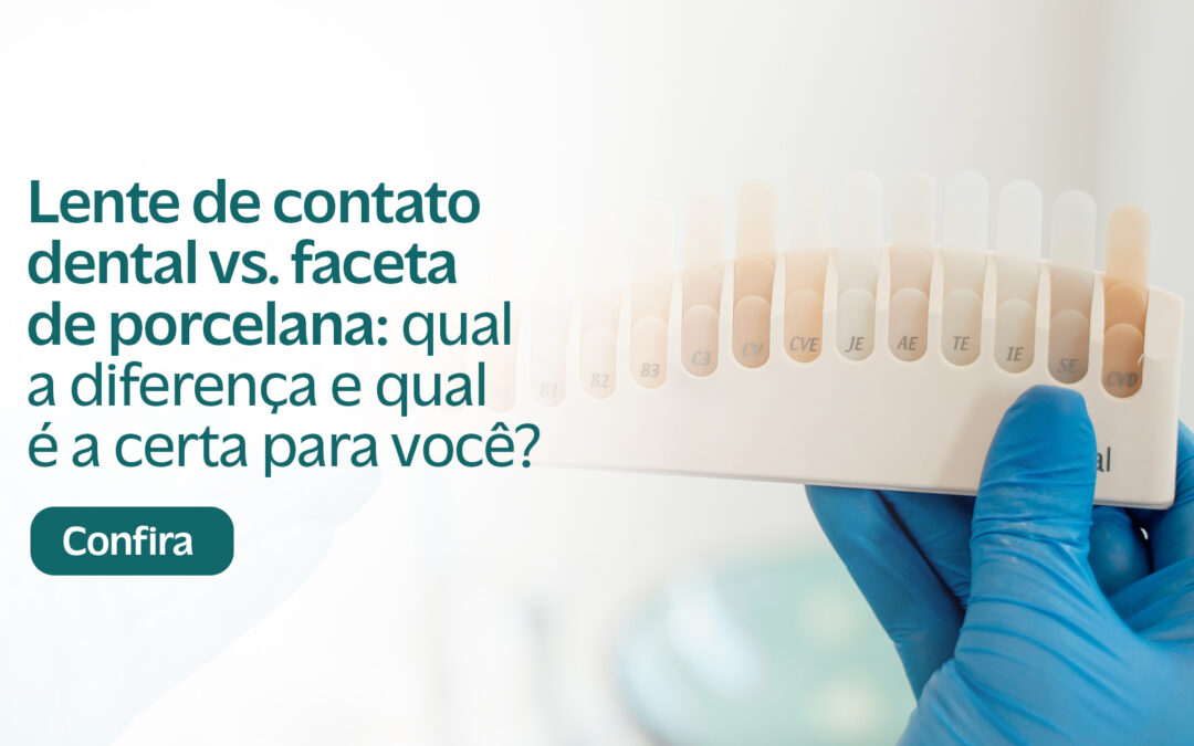 Lente de contato dental vs. faceta de porcelana: qual a diferença e qual é a certa para você?