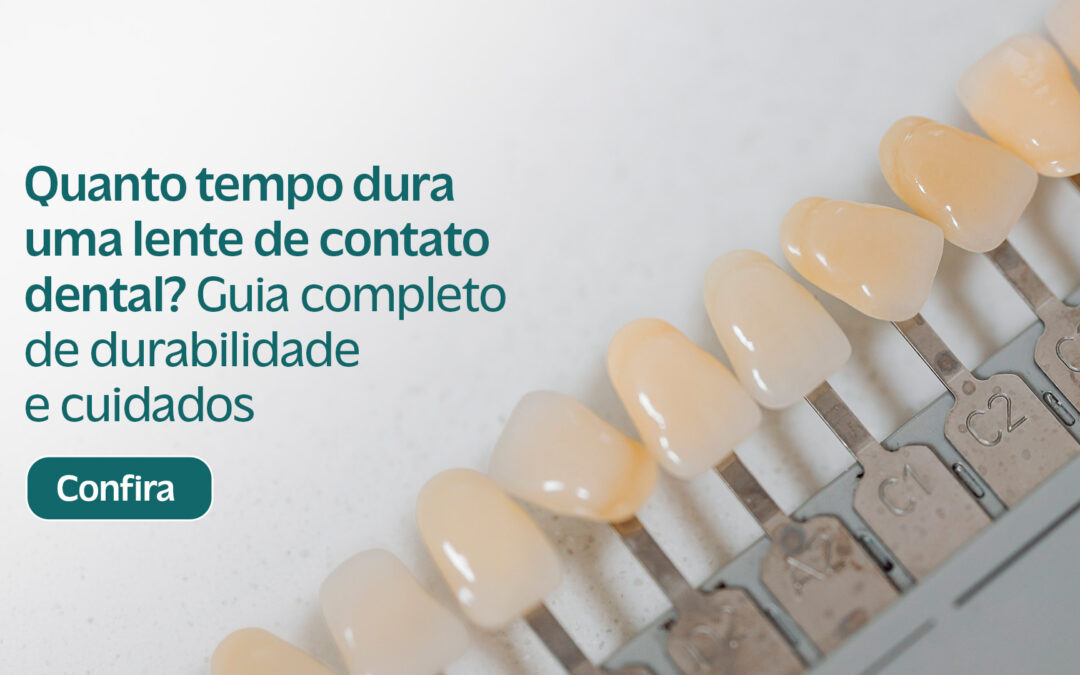 Quanto tempo dura uma lente de contato dental? Guia completo de durabilidade e cuidados