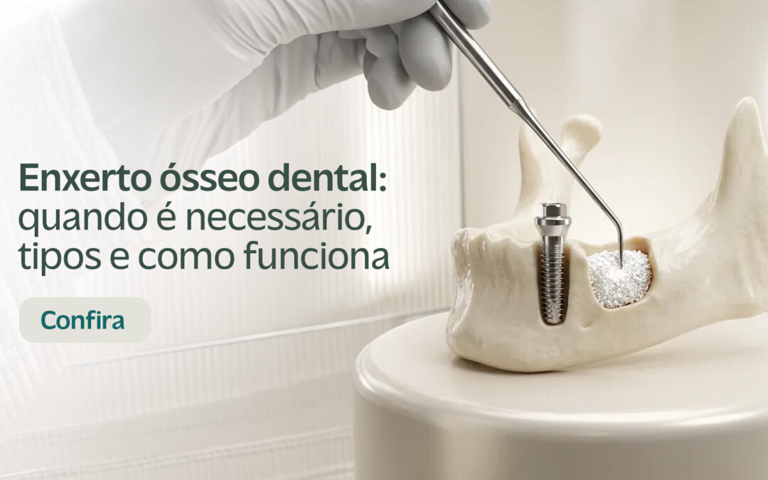 Enxerto Ósseo Dental: Quando é Necessário, Tipos e Como Funciona