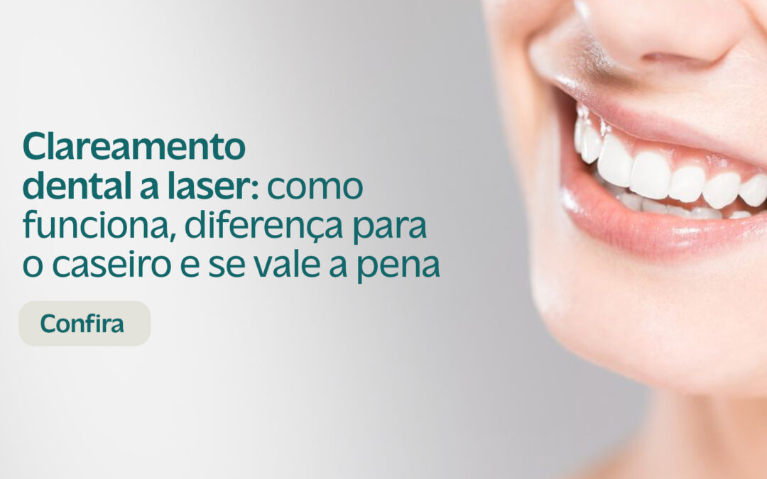 Clareamento Dental a Laser: Como Funciona, Diferença para o Caseiro e Se Vale a Pena