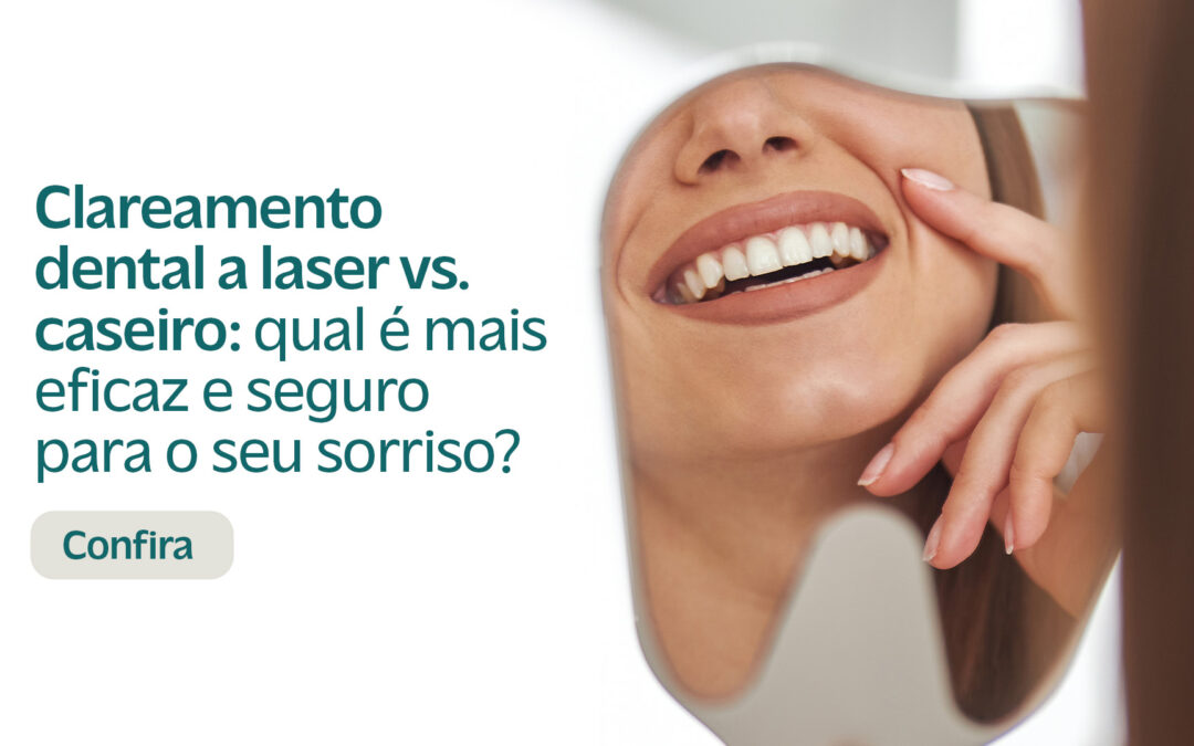 Clareamento dental a laser vs. caseiro: qual é mais eficaz e seguro para o seu sorriso?