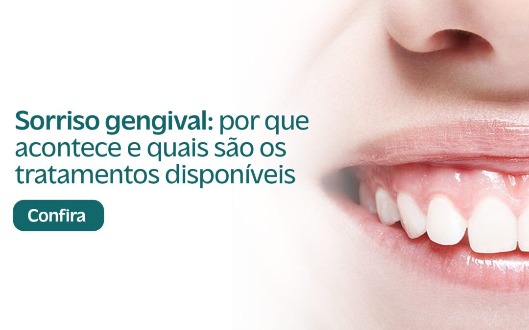 Sorriso Gengival: Por Que Acontece e Quais São os Tratamentos Disponíveis