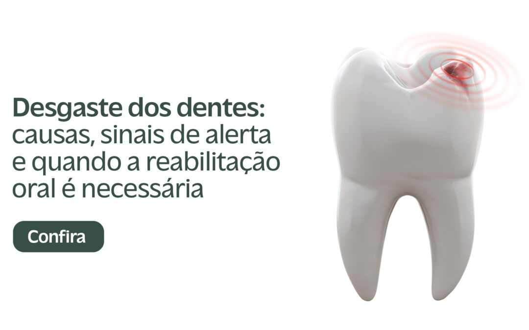 Desgaste dos dentes: causas, sinais de alerta e quando a reabilitação oral é necessária