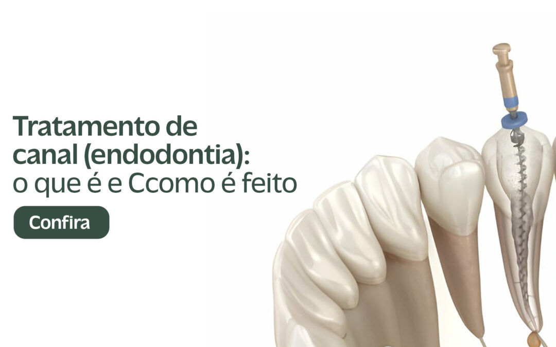 Tratamento de Canal (Endodontia): O Que É e Como é Feito